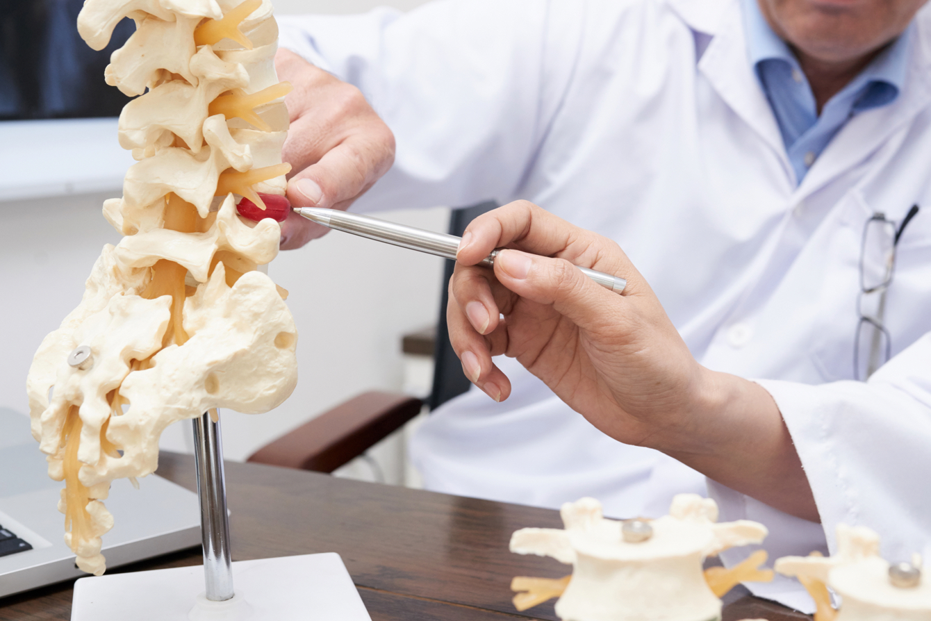 Doctors looking at model of a vertebrae